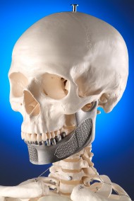 Totenkopf <br />Kunde: MCP-HEK GmbH